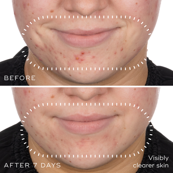 Niacinamide Peptides-hover-5