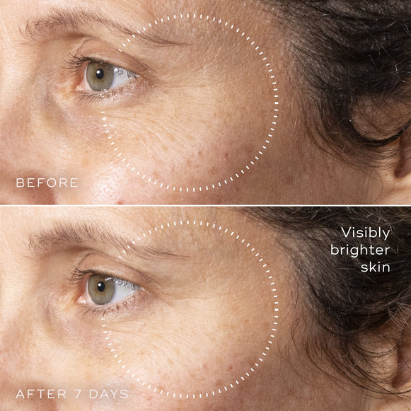C-Tetra™ Advanced Gel-Serum-hover-2