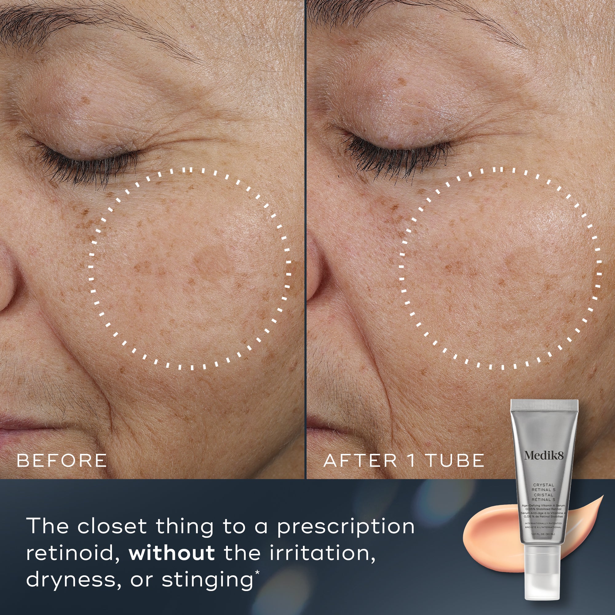 Crystal Retinal for Skin - Retinal Serum – Medik8-CA
